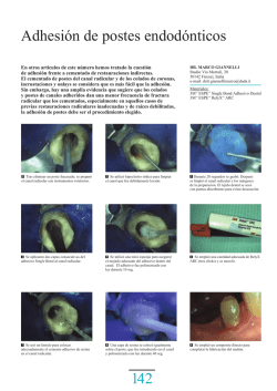 Adhesi&oacute;n de postes endod&oacute;nticos - 3M
