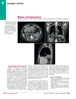 Imagen clinica -Ri&ntilde;on intrator&aacute;cico.cdr - Revista M&eacute;dica MD