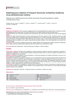 radiofrequency ablation of Frequent Ventricular arrhythmia Guided