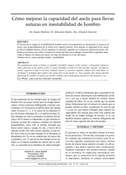 C&oacute;mo mejorar la capacidad del ancla para llevar suturas en