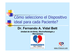 C&oacute;mo selecciono el Dispositivo ideal para cada Paciente? - Ritmocor