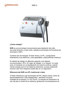 &iquest;C&oacute;mo trabaja? SHR es una tecnolog&iacute;a revolucionaria para