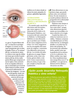 &iquest;Qui&eacute;n puede desarrollar Retinopat&iacute;a Diab&eacute;tica y c&oacute;mo evitarla