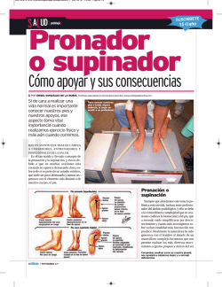 C&oacute;mo apoyar y sus consecuencias - Podologia deportiva Angel de