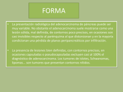 &bull; La presentaci&oacute;n radiol&oacute;gica del adenocarcinoma de p&aacute;ncreas