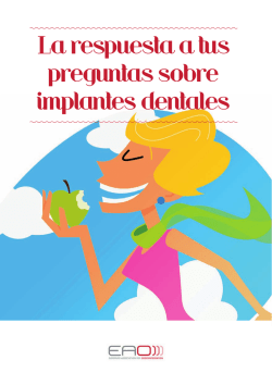 La respuesta a tus preguntas sobre implantes dentales