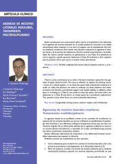 Agenesia de Incisivos Laterales