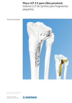 Placa LCP 3.5 para tibia proximal. Sistema LCP de