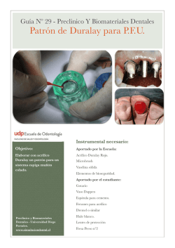 Patr&oacute;n de Duralay para SEM en PFU