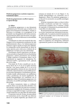 130 Pioderma gangrenoso: excelente respuesta a tratamiento