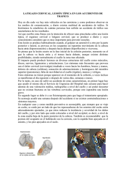 LATIGAZO CERVICAL, LESI&Oacute;N T&Iacute;PICA EN LOS ACCIDENTES DE