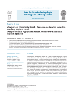 07-HIPOPLASIA NASAL-ENERO-MARZO 42(1)-2014.indd
