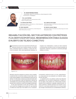 rehabilitaci&oacute;n del sector anterior con pr&oacute;tesis fija
