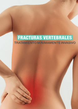 Descargue el folleto paciente