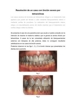 Resoluci&oacute;n de un caso con tinci&oacute;n severa por tetraciclinas