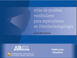 nistagmo espont&aacute;neo y de posici&oacute;n