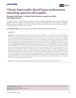 Chronic hypertrophic discoid lupus erythematosus mimicking