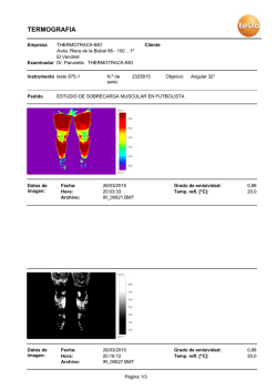 5. estudio termogr&aacute;fico a un futbolista sobrecarga muscular