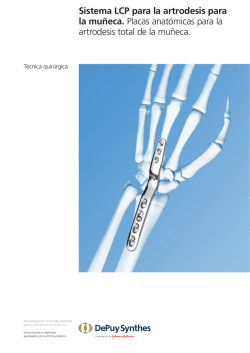 Sistema LCP para la artrodesis para la mu&ntilde;eca. Placas anat&oacute;micas
