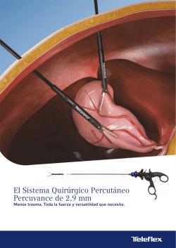El Sistema Quir&uacute;rgico Percut&aacute;neo Percuvance de 2,9 mm
