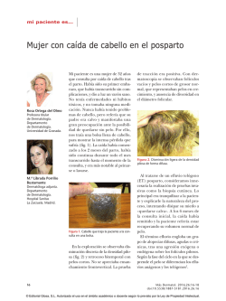 Mujer con ca&iacute;da de cabello en el posparto