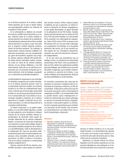 Acute transverse myelitis: Treatment of pain (PDF