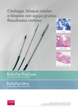 Citolog&iacute;a, bloque celular o biopsia con aguja gruesa