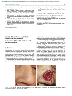 Manejo del carcinoma basocelular con infiltraci&oacute;n perineural