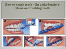 How to brush teeth &ndash; An orthodontist&rsquo;s views on brushing teeth