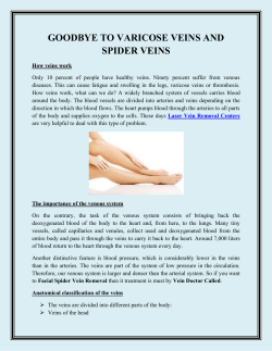 GOODBYE TO VARICOSE VEINS AND SPIDER VEINS