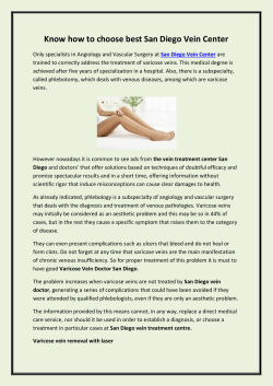 Know how to choose best San Diego Vein Center