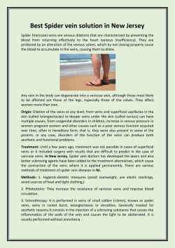 Best Spider vein solution in New Jersey