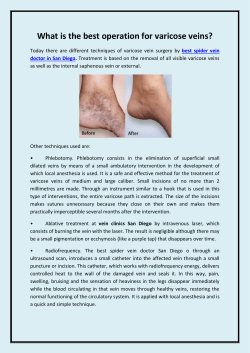 What is the best operation for varicose veins