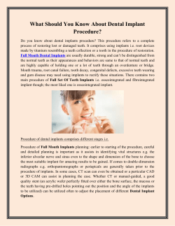 What Should You Know About Dental Implant Procedure