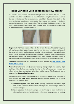 Best Varicose vein solution in New Jersey
