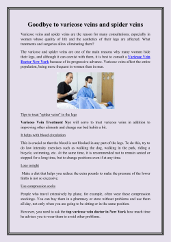 Goodbye to varicose veins and spider veins