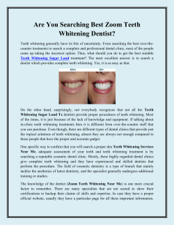 Are You Searching Best Zoom Teeth Whitening Dentist