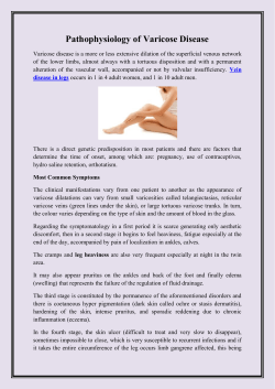 Pathophysiology of Varicose Disease