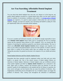 Are You Searching Affordable Dental Implant Treatment