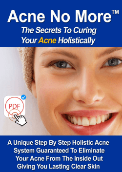 Acne No More PDF EBook Mike Walden Download Free Report
